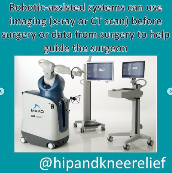 What is Robotic Assisted Joint Replacement Surgery