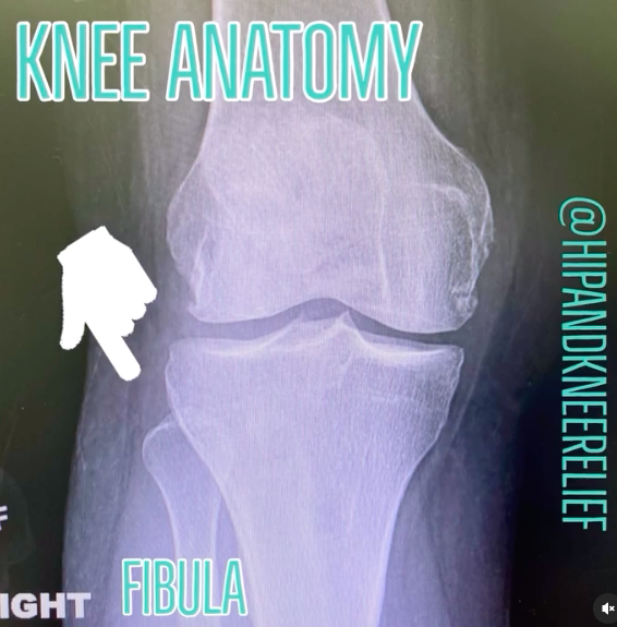 Knee anatomy fibula