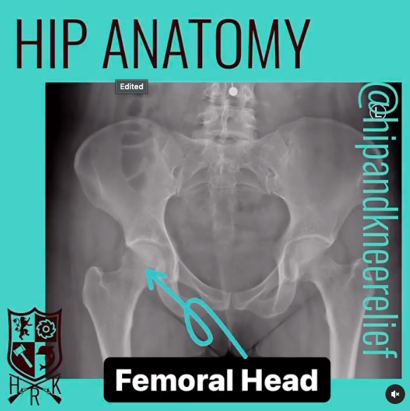 Hip anatomy femoral head