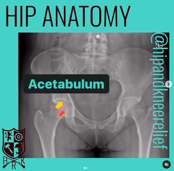 Hip anatomy acetabulum