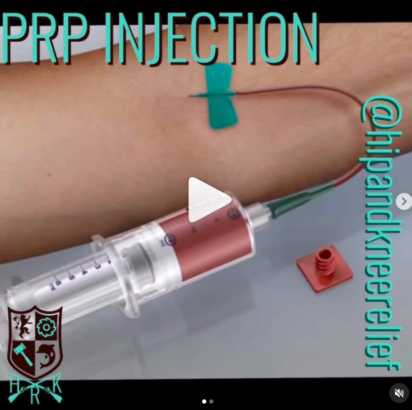 Platelet rich plasma PRP injection