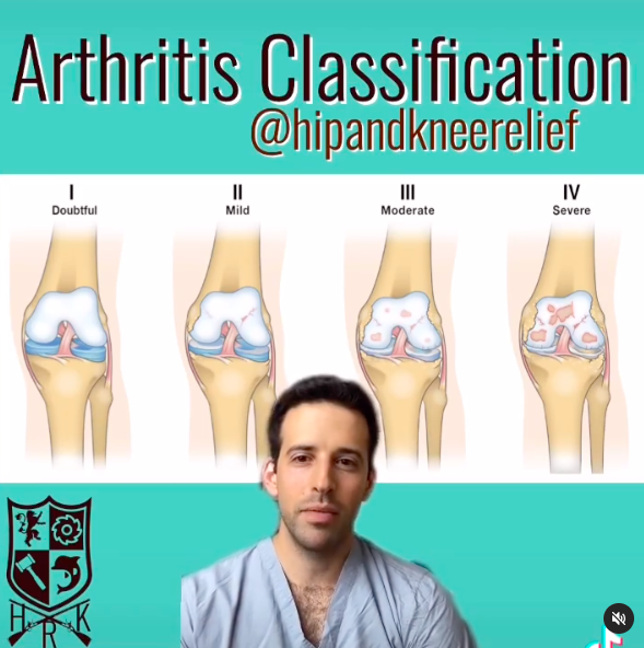 Arthritis Classification Video